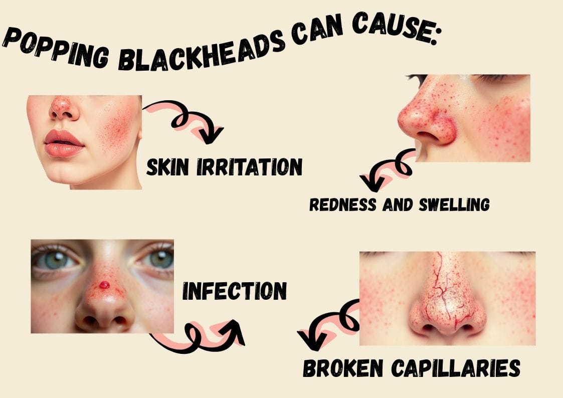 Infographic showing that Popping Blackheads can cause skin irritation, redness and swelling, infection, and broken capillaries on the nose and cheeks.