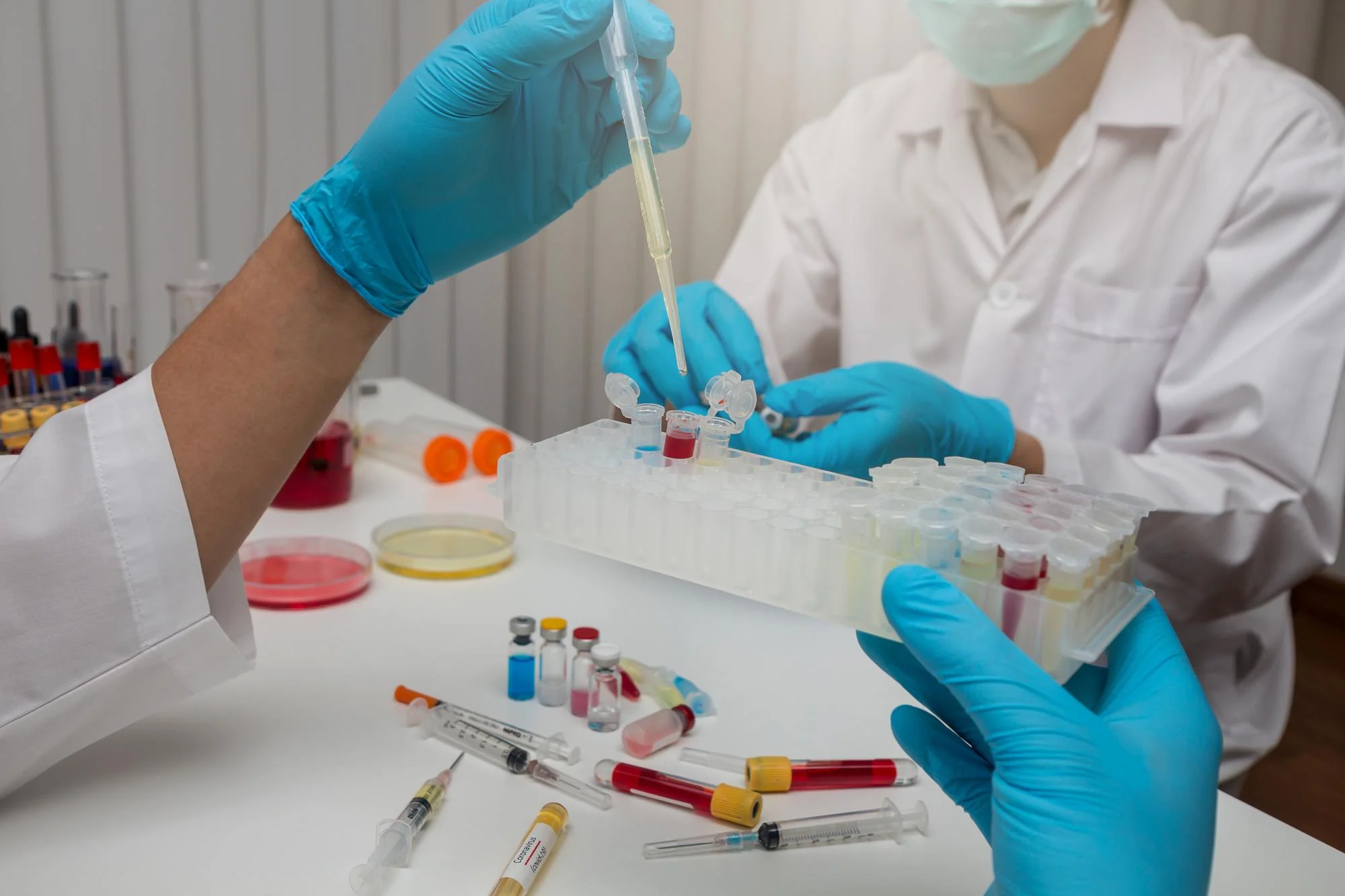 PCR and serological testing methods used for the detection of varicella-zoster virus (VZV).