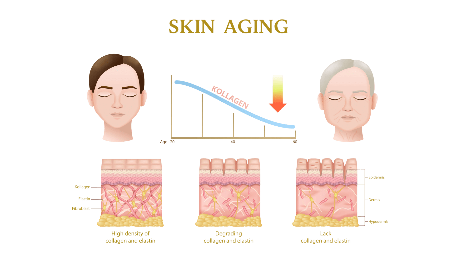 Illustration of skin aging showing declining collagen levels from age 20 to 60, with comparison of youthful high collagen density, midlife collagen degradation, and aged skin with reduced collagen and elastin across epidermis, dermis, and hypodermis layers.