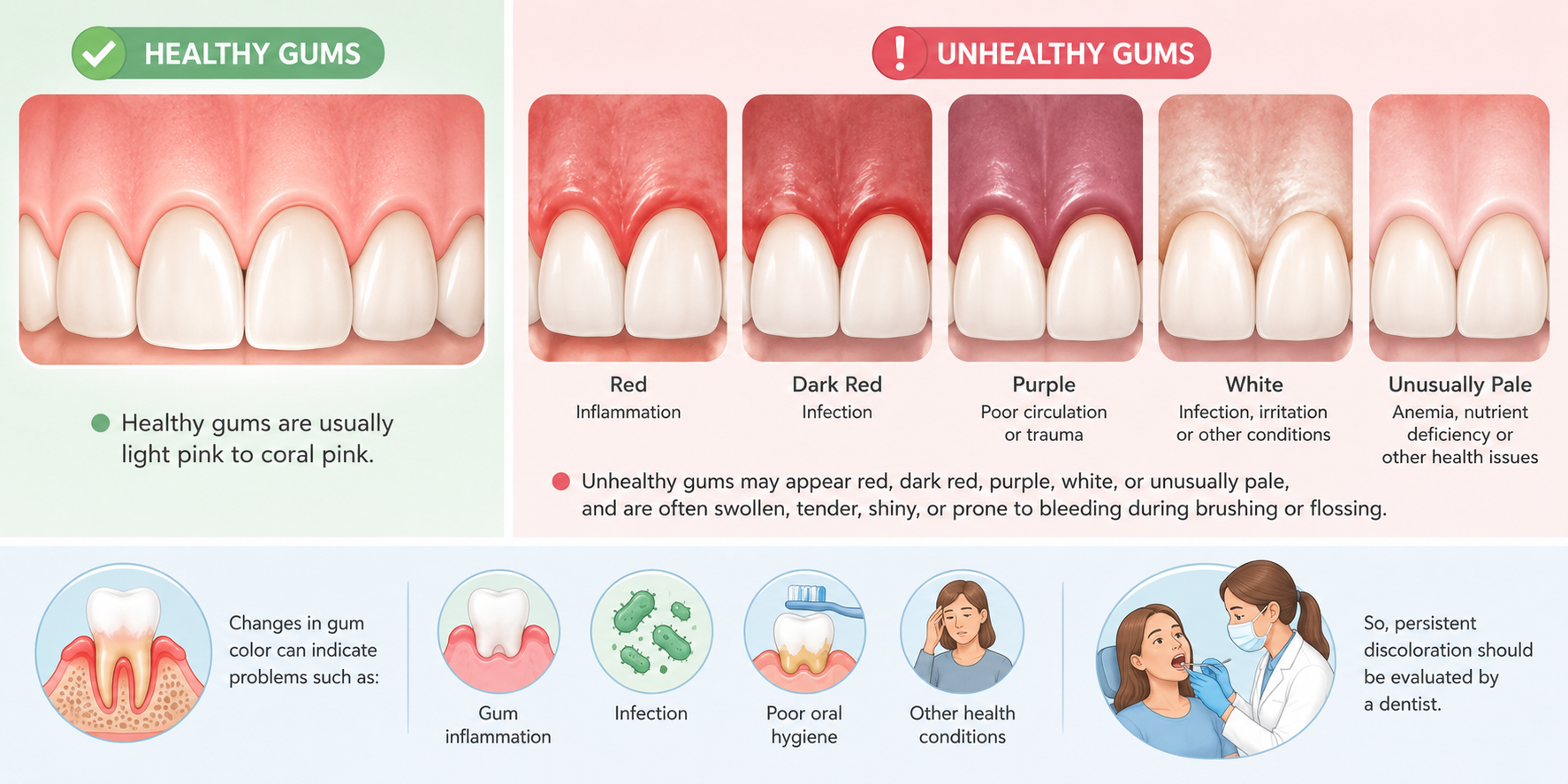 Medical illustration comparing healthy vs unhealthy gum colour, showing normal pink gums alongside white, pale, red, and swollen gums to explain Why Are My Gums White Instead of Pink and when colour changes may indicate oral health problems.