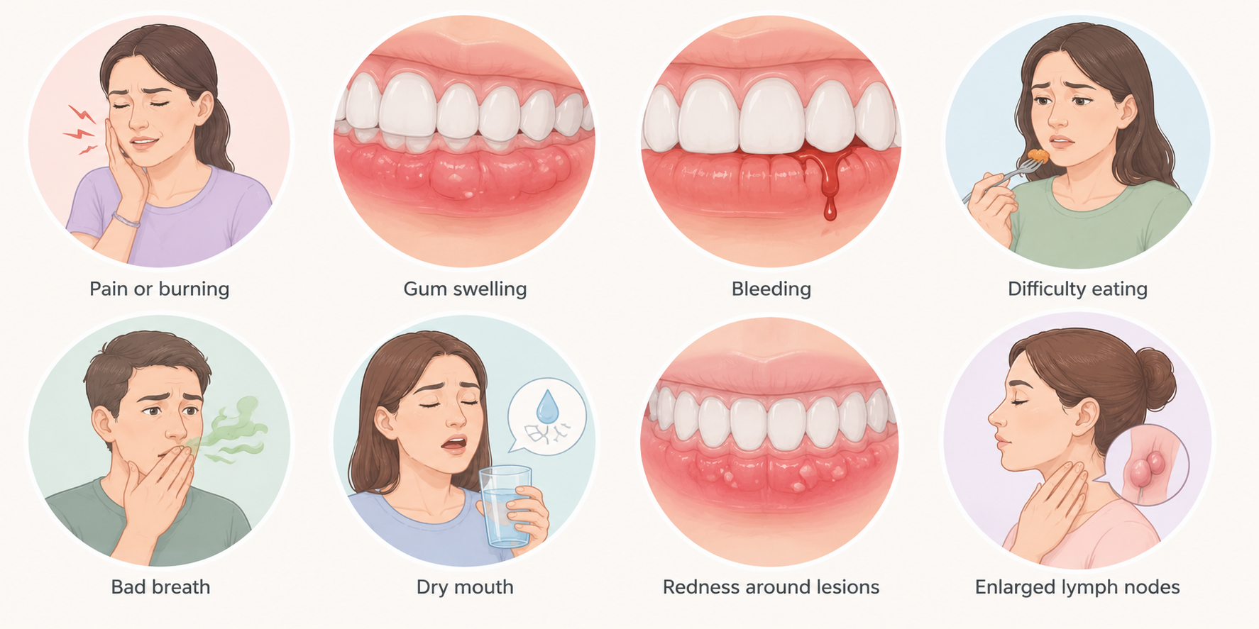 Medical illustration showing symptoms that may accompany White Spots on Gums