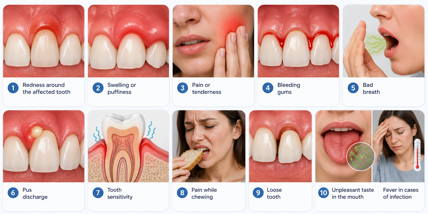 Medical illustration showing the common symptoms of Swollen Gums Around One Tooth.