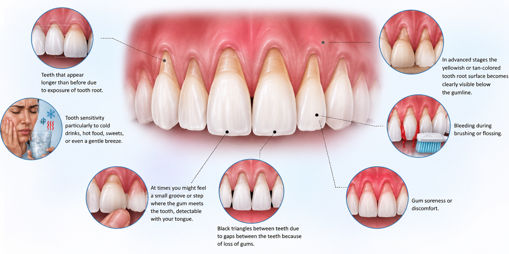 Protect Your Smile by Identifying the Signs of Gum Recession