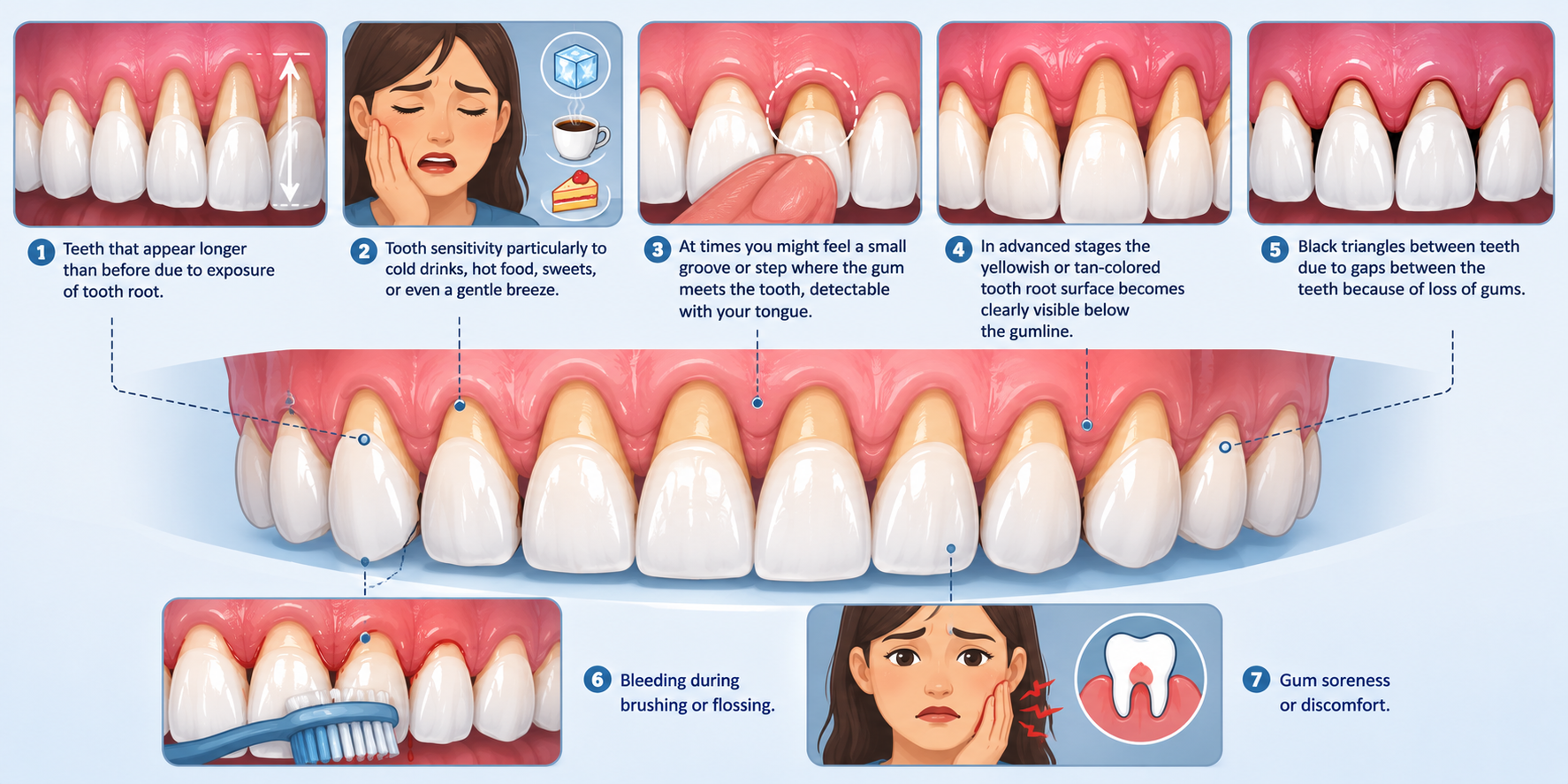 Educational infographic showing what gum recession looks like, including exposed tooth roots, sensitivity, bleeding gums, black triangles, and gum discomfort.