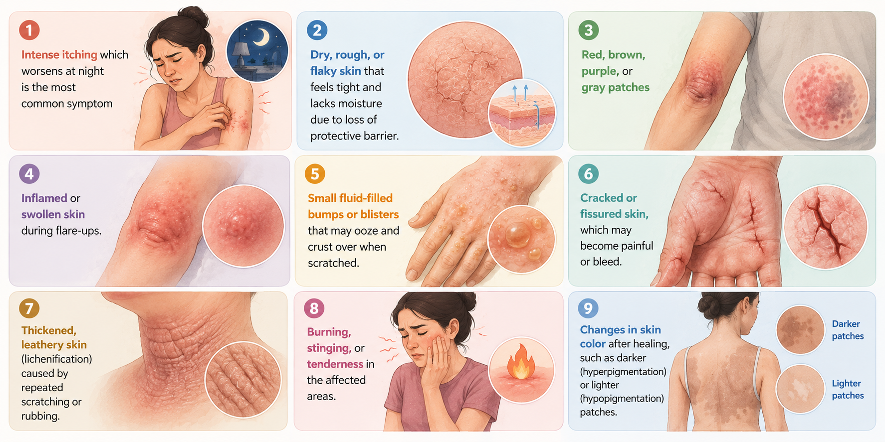 Medical illustration showing eczema symptoms including intense nighttime itching, dry flaky skin, red or discolored patches, inflamed skin, fluid-filled blisters, cracked skin, thickened leathery skin from scratching, burning or stinging sensations, and skin color changes after healing.